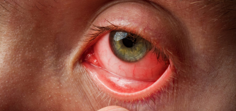 What to do if your surgeon fails to diagnose your retinal problems?