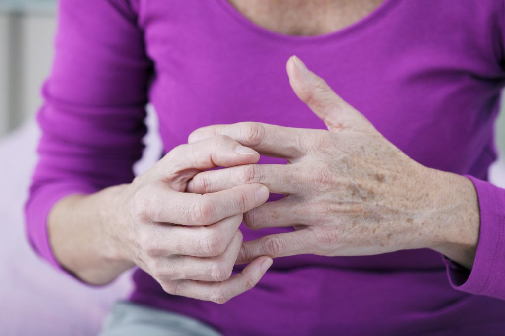 Arthritis Treatment Options