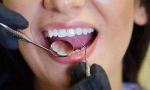 Learning The Good Side of Dental Implants For a Healthy Lifestyle