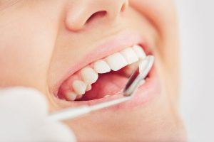 Oral Hygiene