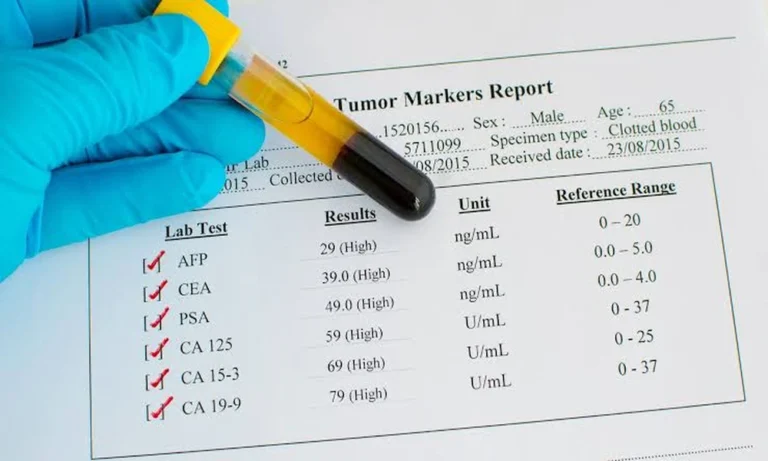 Understanding Your Cancer Marker Test Results